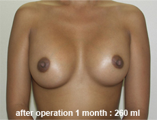 plastic-surgery-breast-augmentation 