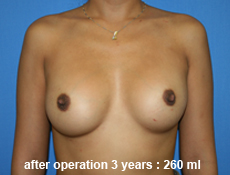 plastic-surgery-breast-augmentation 