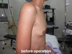 plastic-surgery-breast-augmentation